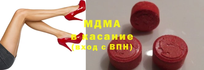 мет Абаза
